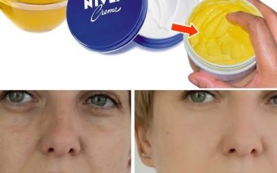 a homemade anti-aging cream made by mixing Nivea Creme with an oil (possibly olive oil) and claims dramatic wrinkle reduction.