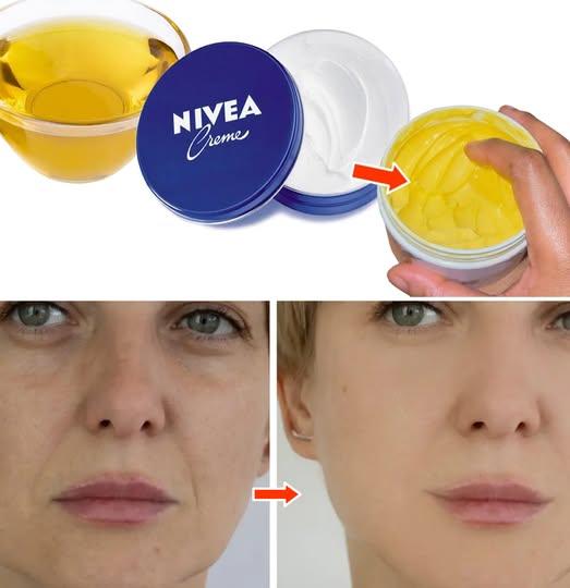 a homemade anti-aging cream made by mixing Nivea Creme with an oil (possibly olive oil) and claims dramatic wrinkle reduction.