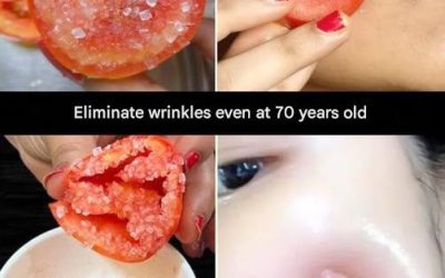 At 20, the goal is generally not to treat wrinkles, but to preserve the skin and prevent future damage.
