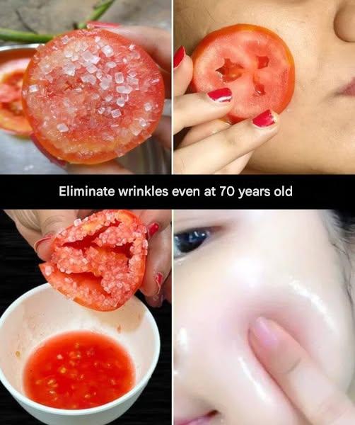 At 20, the goal is generally not to treat wrinkles, but to preserve the skin and prevent future damage.