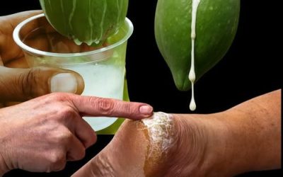 The white liquid shown dripping from the fruit is papaya latex (sap).Can it heal cracked heels?