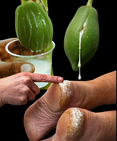 The white liquid shown dripping from the fruit is papaya latex (sap).Can it heal cracked heels?